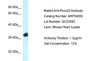 Western Blotting (WB) image for anti-F-Box Protein 22 (FBXO22) (Middle Region) antibody (ABIN2785926) (FBXO22 anticorps  (Middle Region))