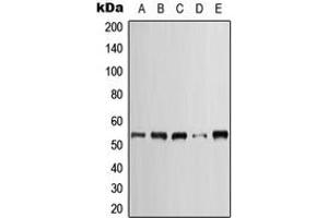 Western blot analysis of Cytokeratin 7 expression in HeLa (A), SP2/0 (B), H9C2 (C), A431 (D), NIH3T3 (E) whole cell lysates. (Cytokeratin 7 anticorps  (C-Term))