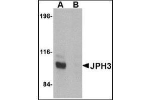 Western blot analysis of JPH3 in Daudi cell lysate with this product at 1 μg/ml in (A) the absence and (B) the presence of blocking peptide.