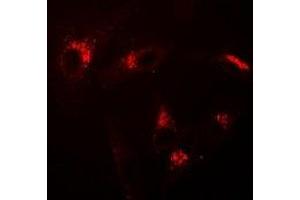 Immunofluorescent analysis of USP10 staining in A549 cells. (USP10 anticorps)