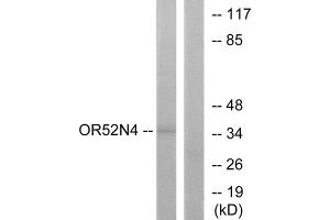 Western blot analysis of extracts from HeLa cells, using OR52N4 antibody. (OR52N4 anticorps  (C-Term))