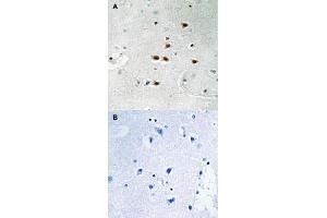 Immunohistochemical staining of human brain tissue by ITCH (phospho Y420) polyclonal antibody  without blocking peptide (A) or preincubated with blocking peptide (B) under 1:50-1:100 dilution. (ITCH anticorps  (pTyr420))
