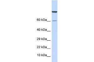 WB Suggested Anti-ZNF251 Antibody Titration:  0. (ZNF251 anticorps  (Middle Region))