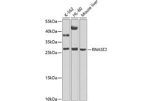 Western blot analysis of extracts of various cell lines, using RN antibody (ABIN6131626, ABIN6146986, ABIN6146987 and ABIN6225283) at 1:1000 dilution. (RNASE2 anticorps  (AA 28-161))