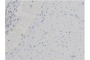 ABIN6267390 at 1/200 staining Human esophagus tissue sections by IHC-P.