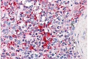 Human Spleen: Formalin-Fixed, Paraffin-Embedded (FFPE) (TLN1 anticorps  (AA 1052-1150))