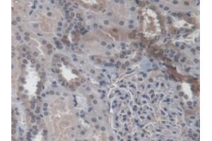 Detection of RAB37 in Human Kidney Tissue using Polyclonal Antibody to RAB37, Member RAS Oncogene Family (RAB37) (RAB37 anticorps  (AA 19-220))