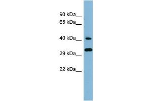 WB Suggested Anti-RBJ Antibody Titration: 0. (DNAJC27 anticorps  (Middle Region))