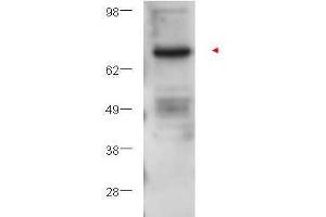 Western blot using  affinity purified anti-PKC beta antibody shows detection of PKC beta in ~25 ?
