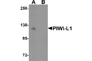 Western Blotting (WB) image for anti-Piwi-Like 1 (PIWIL1) (N-Term) antibody (ABIN1031515) (PIWIL1 anticorps  (N-Term))