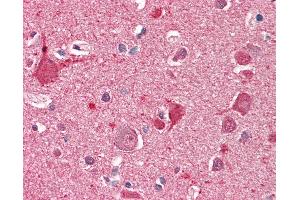 Anti-DOC2A antibody IHC staining of human brain, cortex. (DOC2A anticorps  (AA 233-246))
