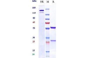 Anti-OSMR Reference Antibody (vixarelimab) on SDS-PAGE under reducing (R) condition. (Recombinant OSMR (Vixarelimab Biosimilar) anticorps)
