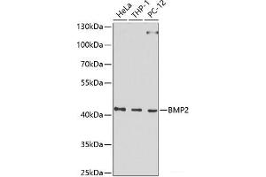 Western blot analysis of extracts of various cell lines using BMP2 Polyclonal Antibody at dilution of 1:1000. (BMP2 anticorps)
