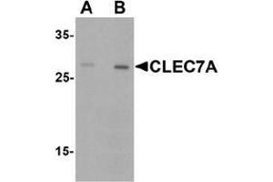 Western blot analysis of CLEC7A in rat spleen tissue lysate with CLEC7A antibody at (A) 1 and (B) 2 µg/. (CLEC7A anticorps  (Middle Region))
