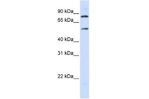 WB Suggested Anti-SLC27A4 Antibody Titration:  0.