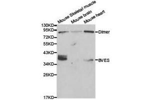 Western Blotting (WB) image for anti-Blood Vessel Epicardial Substance (BVES) antibody (ABIN1871374) (BVES anticorps)
