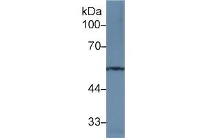 Detection of MMP12 in Rat Spinal cord lysate using Polyclonal Antibody to Matrix Metalloproteinase 12 (MMP12) (MMP12 anticorps  (AA 100-286))