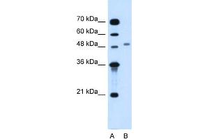 WB Suggested Anti-MGAT2 Antibody Titration:  1. (MGAT2 anticorps  (Middle Region))