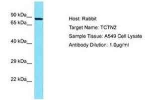Image no. 1 for anti-Tectonic Family Member 2 (TCTN2) (AA 85-134) antibody (ABIN6750681) (TCTN2 anticorps  (AA 85-134))