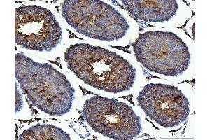 IHC analysis of ME1 using anti-ME1 antibody (ABIN7599485).