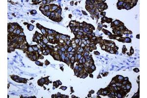 Image no. 2 for anti-ATP-Binding Cassette, Sub-Family B (MDR/TAP), Member 1 (ABCB1) (AA 995-1280) antibody (ABIN1491724)