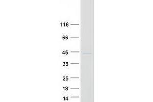 Validation with Western Blot