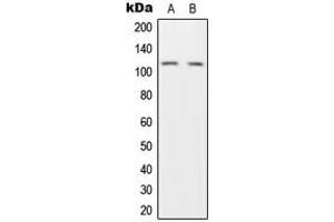 Western blot analysis of HGS expression in H1299 (A), HeLa (B) whole cell lysates. (HGS anticorps  (Center))
