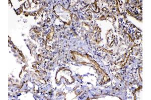IHC analysis of VEGF Receptor 3 using anti-VEGF Receptor 3 antibody .