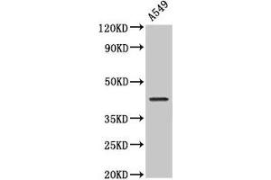 Western Blot Positive WB detected in: A549 whole cell lysate All lanes: NDRG4 antibody at 2 μg/mL Secondary Goat polyclonal to rabbit IgG at 1/50000 dilution Predicted band size: 39, 38, 41, 43, 40 kDa Observed band size: 43 kDa (NDRG4 anticorps  (AA 210-331))