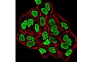 Immunofluorescence analysis of HeLa cells using DNMT3B mouse mAb (green).