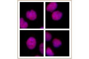 MMSET / WHSC1 antibody (mAb) tested by immunofluorescence. (WHSC1 anticorps  (AA 1-647))