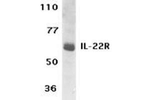 Western blot analysis of IL-22 Receptor expression in human HepG2 cell lysate with AP30416PU-N IL-22 Receptor antibody at 1 μg /ml.