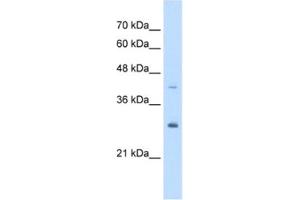 Western Blotting (WB) image for anti-Calcyclin Binding Protein (CACYBP) antibody (ABIN2463420) (CACYBP anticorps)