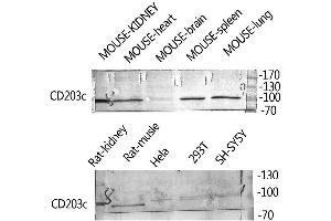 Western Blot (WB) analysis of Rat Kidney HeLa 293T SH-SY5Y Mouse Kidney, Mouse Spleen, Mouse Lung, using ENPP3 Polyclonal Antibody.