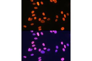 Immunofluorescence analysis of U-2 OS cells using Histone H1. (HIST1H1C anticorps)