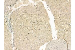 ABIN6262191 and ABIN6269396 at 1/100 staining human normal liver tissue by IHC-P. (HDAC8 anticorps  (N-Term))