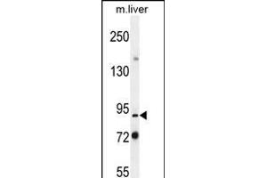 Parp9 Antibody (N-term) (ABIN656129 and ABIN2845470) western blot analysis in mouse liver tissue lysates (35 μg/lane). (PARP9 anticorps  (N-Term))