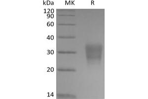 Western Blotting (WB) image for Frizzled Family Receptor 8 (FZD8) protein (Biotin,His-Avi Tag) (ABIN7319923)