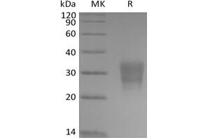 Western Blotting (WB) image for Frizzled Family Receptor 8 (FZD8) protein (Biotin,His-Avi Tag) (ABIN7319923) (FZD8 Protein (Biotin,His-Avi Tag))