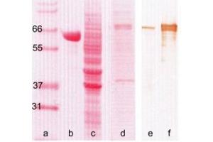 Western Blotting (WB) image for anti-Myxovirus Resistance Protein 1 (MX1) antibody (ABIN781793) (MX1 anticorps)