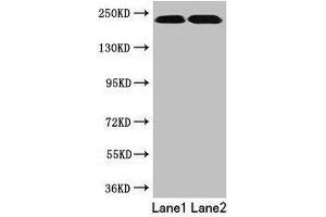 TLN2 Antikörper  (AA 88-406)
