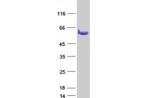 Validation with Western Blot