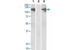 HEK293 lysate (10 ug protein in RIPA buffer) overexpressing human PUM2 with DYKDDDDK tag probed with PUM2 polyclonal antibody  (0. (PUM2 anticorps  (Internal Region))