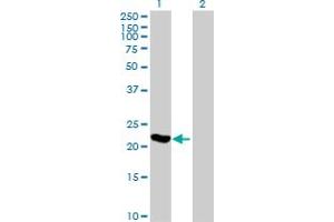 Western Blot analysis of ARL3 expression in transfected 293T cell line by ARL3 MaxPab polyclonal antibody.