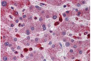 Human Liver: Formalin-Fixed, Paraffin-Embedded (FFPE)