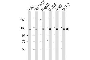 PHC3 抗体  (AA 819-850)