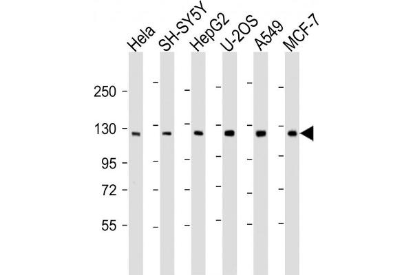 PHC3 抗体  (AA 819-850)