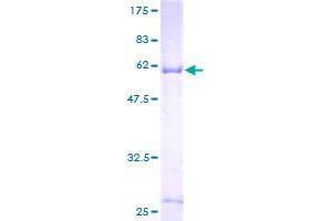 Image no. 1 for Chondroitin Sulfate N-Acetylgalactosaminyltransferase 1 (CSGALNACT1) (AA 1-297) protein (GST tag) (ABIN1350504)