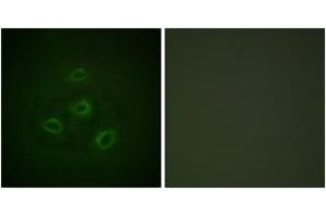 Immunofluorescence analysis of HepG2 cells, using PP2A-alpha (Ab-307) Antibody. (PPP2CA anticorps  (AA 260-309))