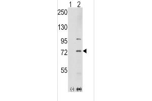 Western blot analysis of K1 (arrow) using rabbit polyclonal K1 Antibody  (ABIN392432 and ABIN2842032). (PAK1 anticorps  (AA 401-430))